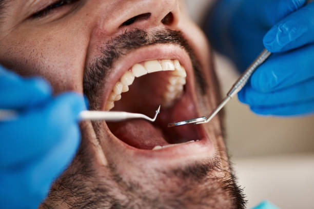 Best Broken or Chipped Tooth Repair in Middle River, MD